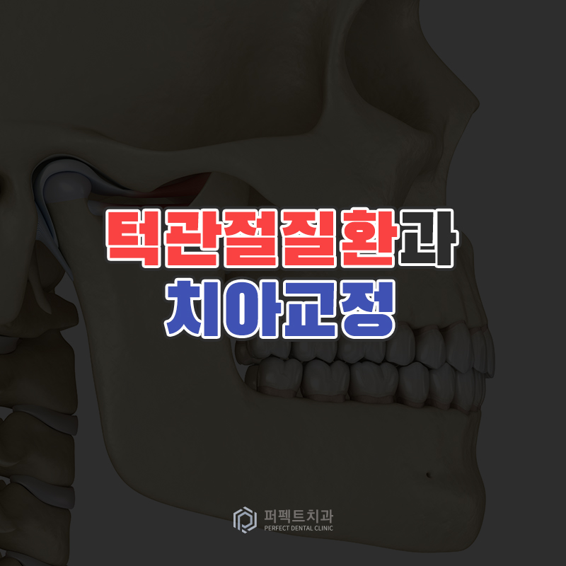 턱관절 안 좋은데 치아교정 가능할까요? 관련 이미지 1