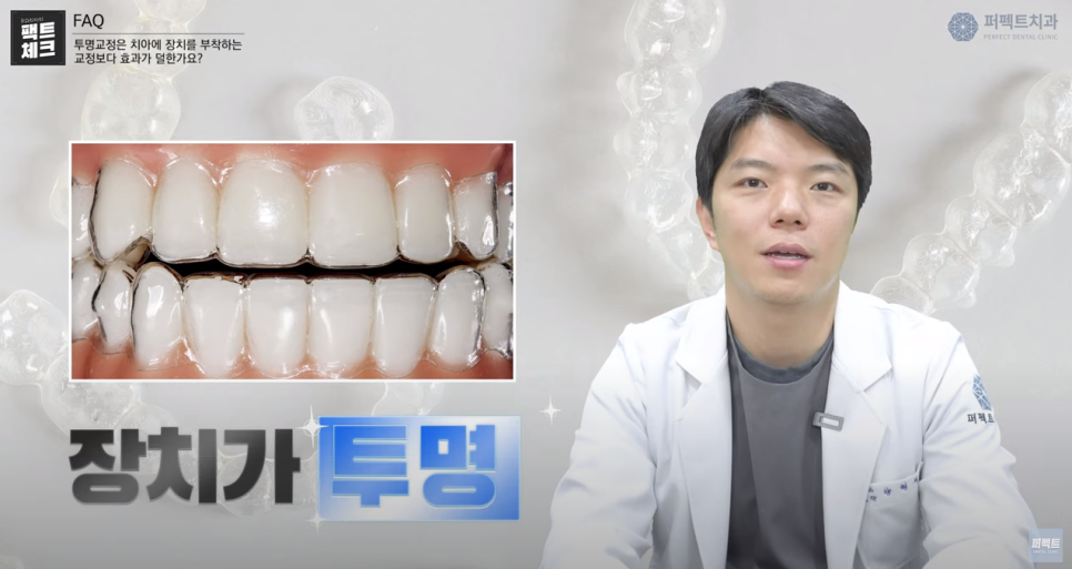 투명교정, 일반교정보다 효과가 덜하다? 관련 이미지 2