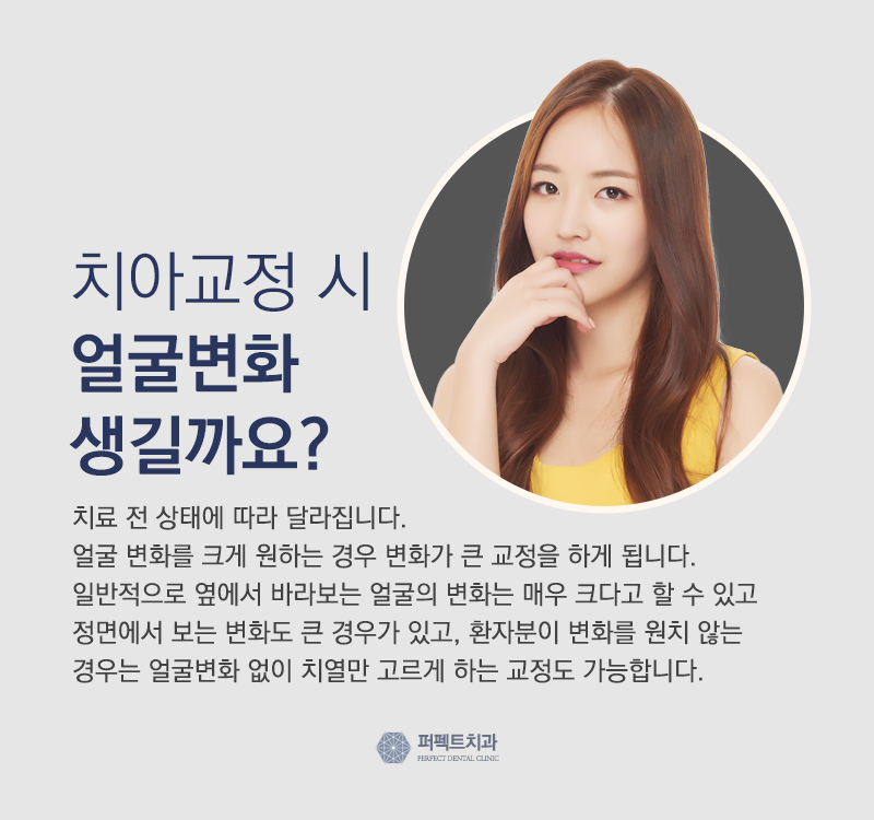 돌출입교정 비용 관련 이미지 6