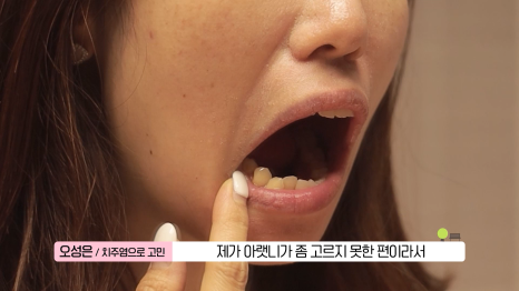 생생정보마당 건강의 기술 출연 치과입니다🙂( 관련 이미지 3