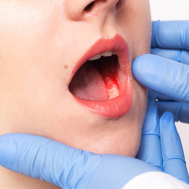 치아 염증을 알리는 증상들 관련 이미지 1