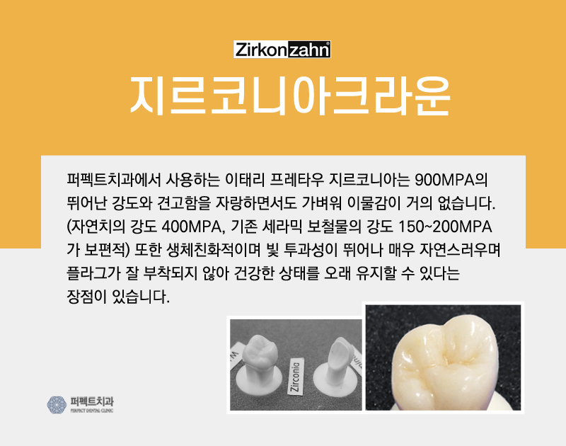 5월 프로모션 진행중인 ▶ 지르코니아 크라운! 관련 이미지 4