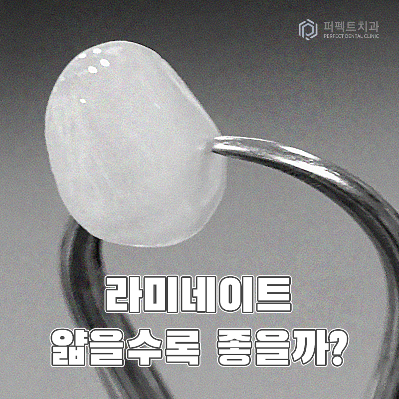 라미네이트는 무조건 얇을 게 좋을까? 관련 이미지 1