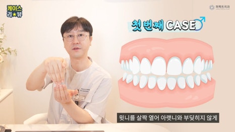 남자라미네이트 치료 결과는? 관련 이미지 1