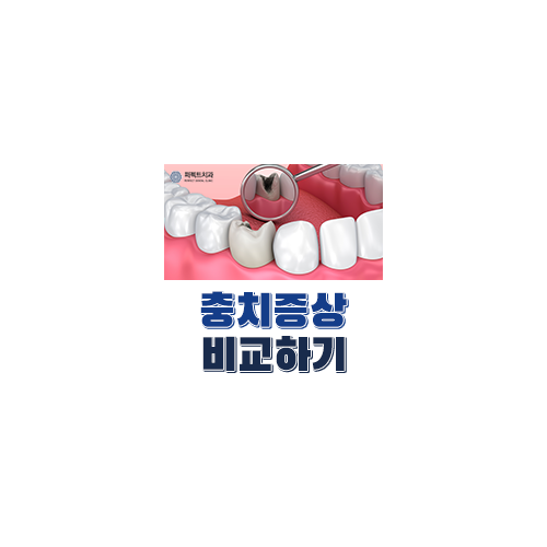 충치 아플때 어떻게? 비용은? 관련 이미지 4