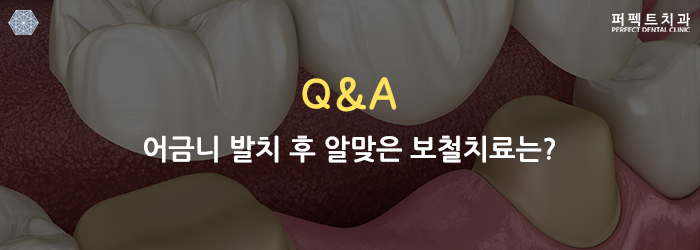 궁금했던 치과 Q&A 물어보세요! 관련 이미지 2