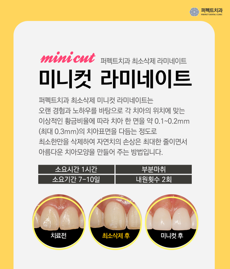 강남라미네이트비용 관련 이미지 4