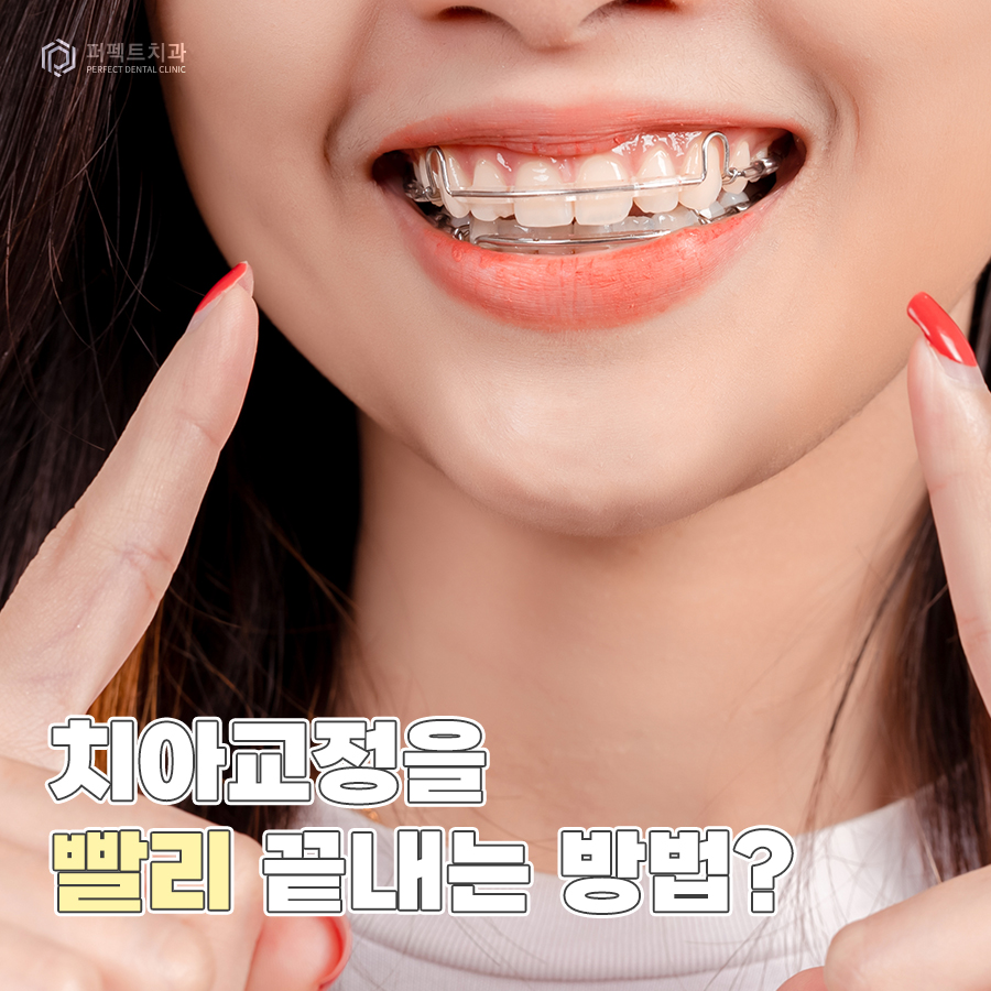 치아교정을 빨리 끝내는 방법이 있다고?! 관련 이미지 1