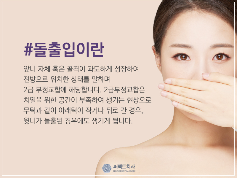 돌출입교정 비용 관련 이미지 1