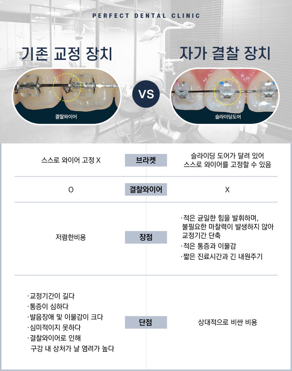 치아교정 클리피씨 교정으로 치료! 관련 이미지 4