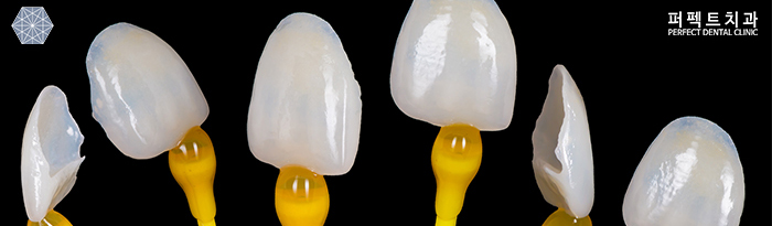 라미네이트 시술 후  주의사항 정리! 관련 이미지 4