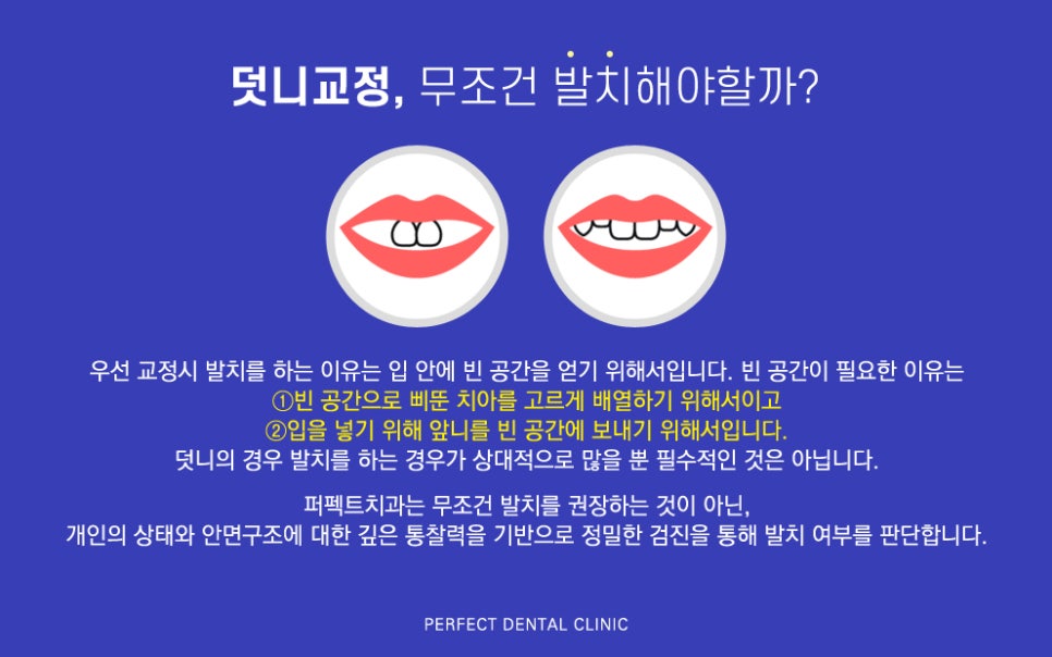 덧니부분교정 후기 좋은 치과 관련 이미지 3