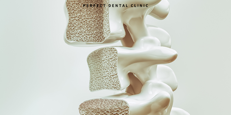 골다공증환자 치과치료 주의사항 관련 이미지 3