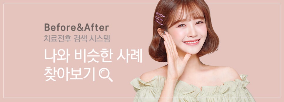 앞니충치? 최소삭제라미네이트or폴리네이트로 치료! 관련 이미지 6