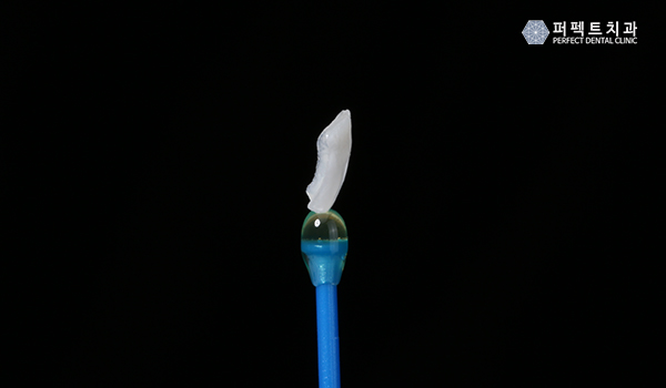 강남라미네이트 인정받은 치과 관련 이미지 2