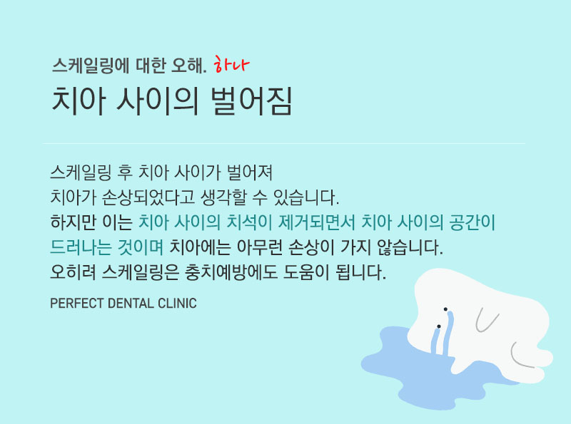 스케일링 아픈가요? 관련 이미지 5