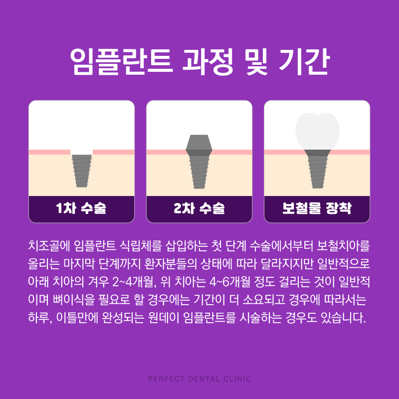 오스템 칼슘 임플란트 믿고 맡길수 있는 강남치과 관련 이미지 1