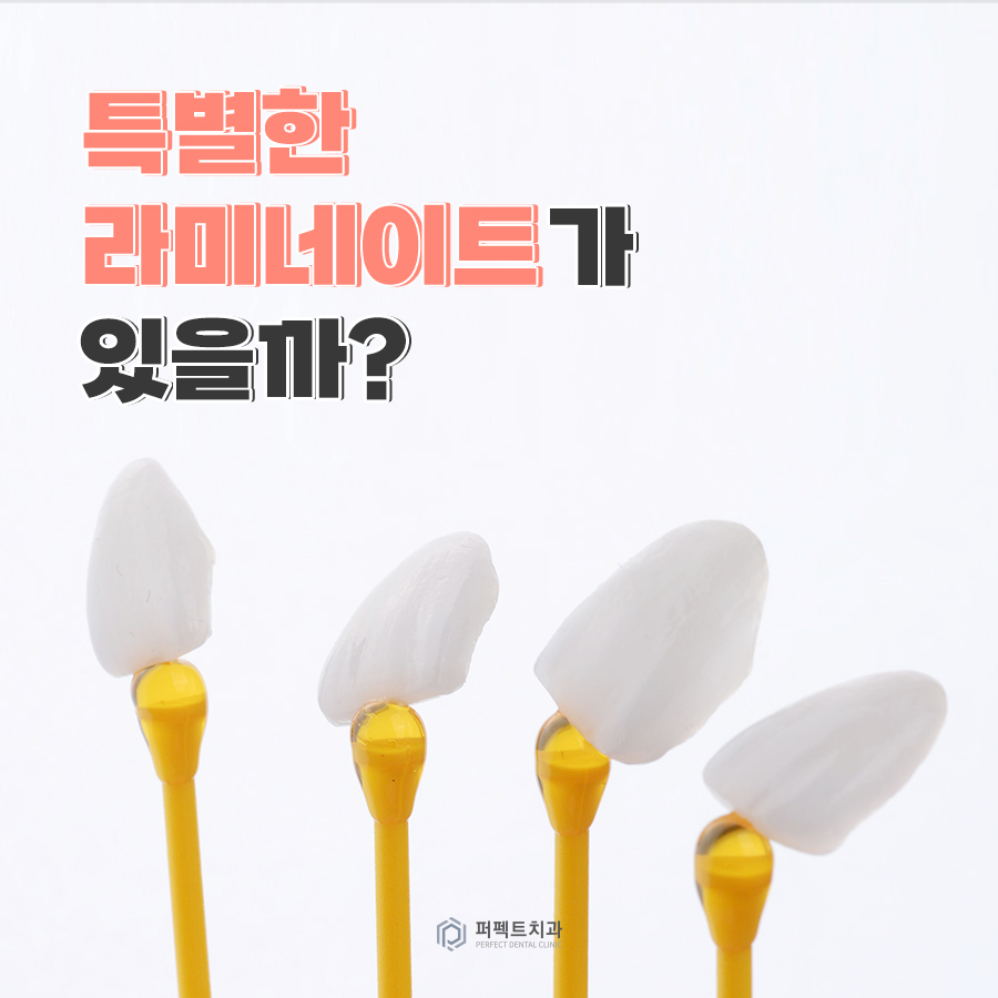 특별한✨ 라미네이트가 있을까? 관련 이미지 1