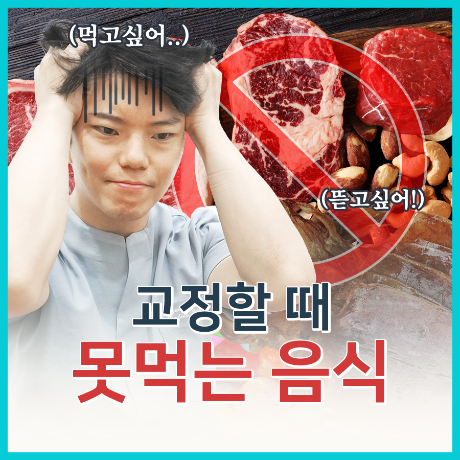 교정 중 못 먹는 음식 vs 먹기 좋은 음식 관련 이미지 4