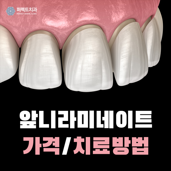 앞니라미네이트 퍼펙트한 비용 확인하기! 관련 이미지 1