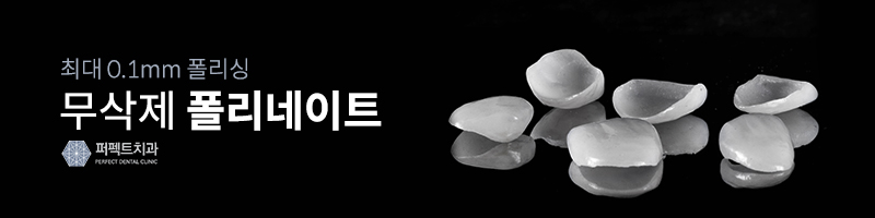0.1mm 최소삭제, 앞니 라미네이트 후기 관련 이미지 2