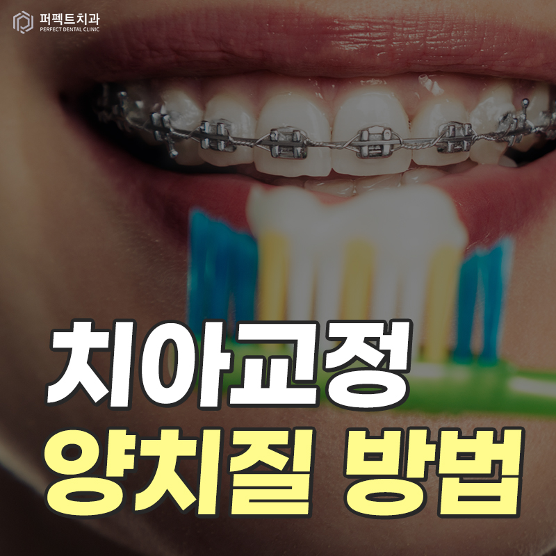 치아교정양치질, 어떻게 닦을까? 관련 이미지 1