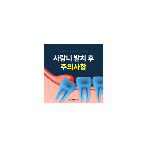 사랑니 발치 후 주의사항은? 관련 이미지 5