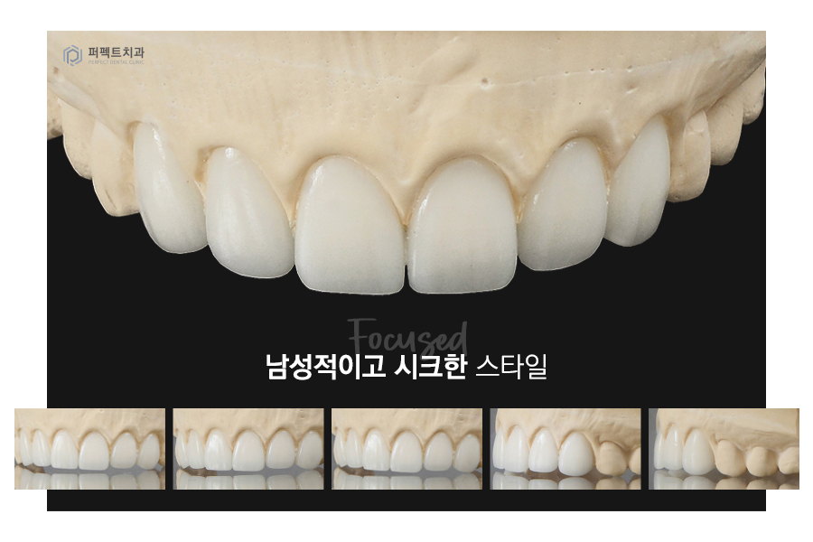 라미네이트를 해야한다면? 색상, 모양을 결정하는 tip! 관련 이미지 4