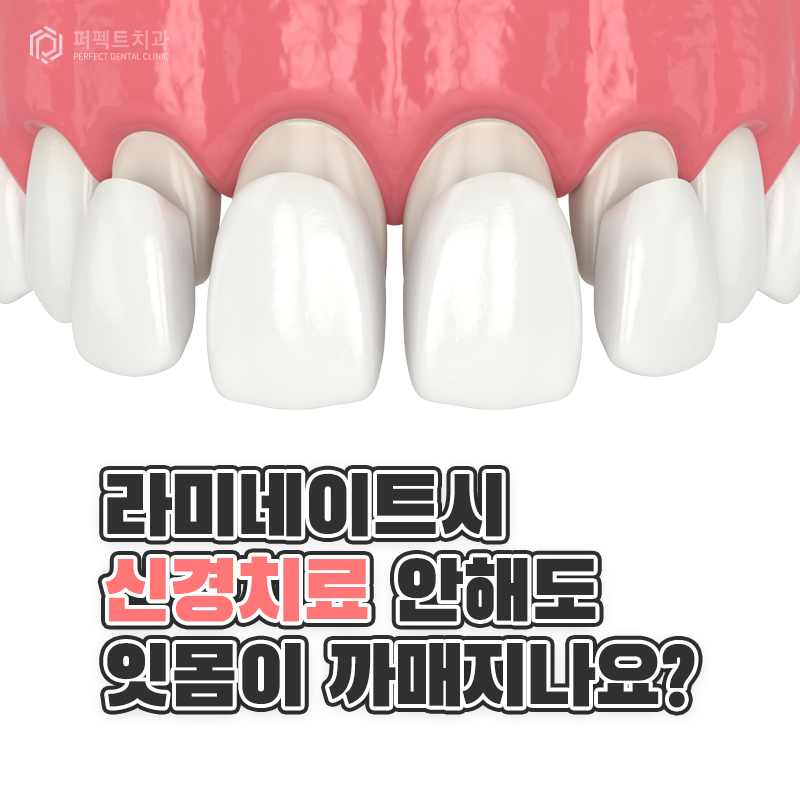 라미네이트시 신경치료 안해도 잇몸이 까매지나요? 관련 이미지 1