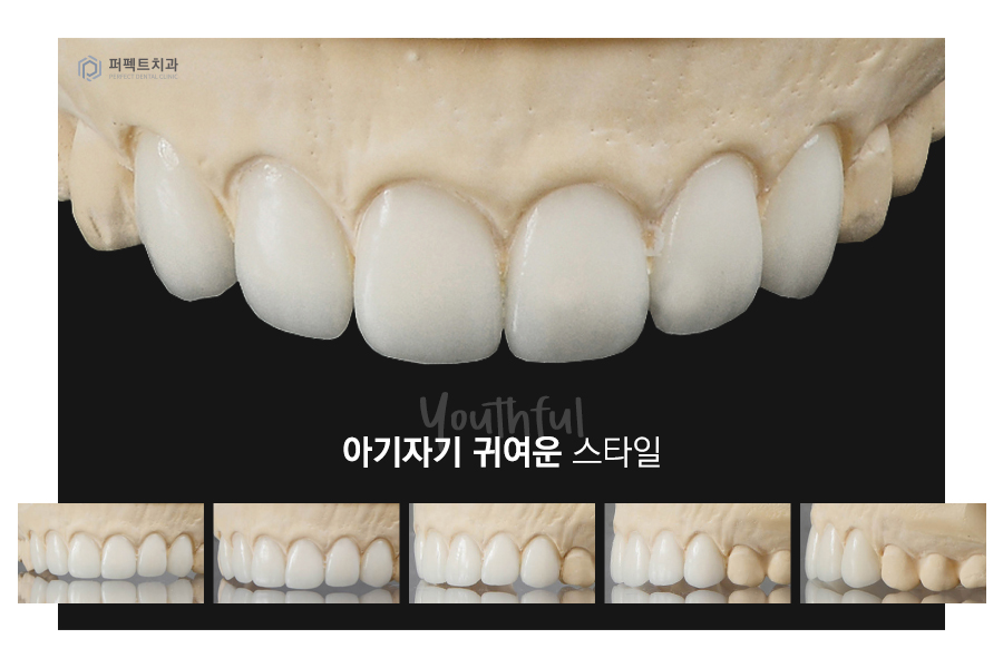 라미네이트를 해야한다면? 색상, 모양을 결정하는 tip! 관련 이미지 3