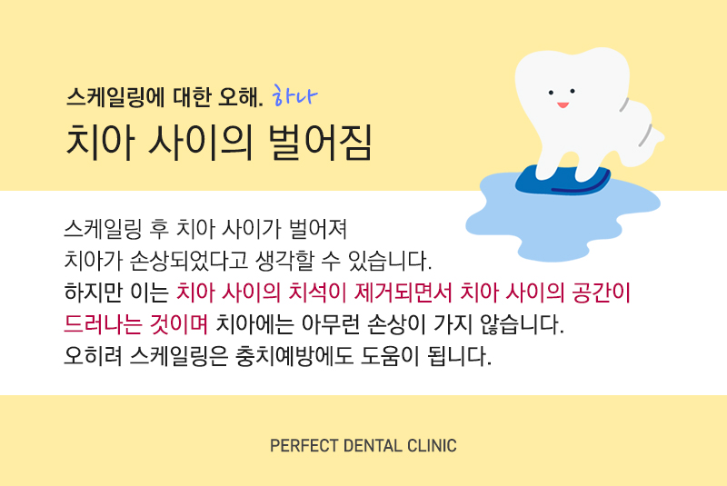 스케일링 의료보험 관련 이미지 5