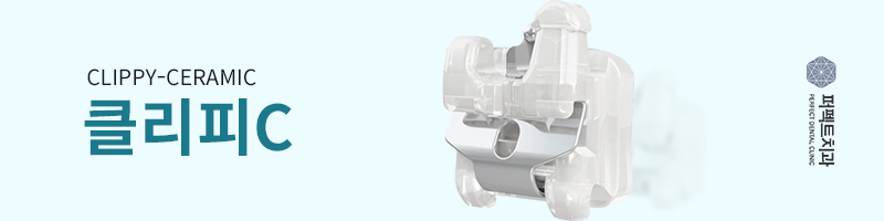 앞니 뻐드렁니 교정 전/후 관련 이미지 2