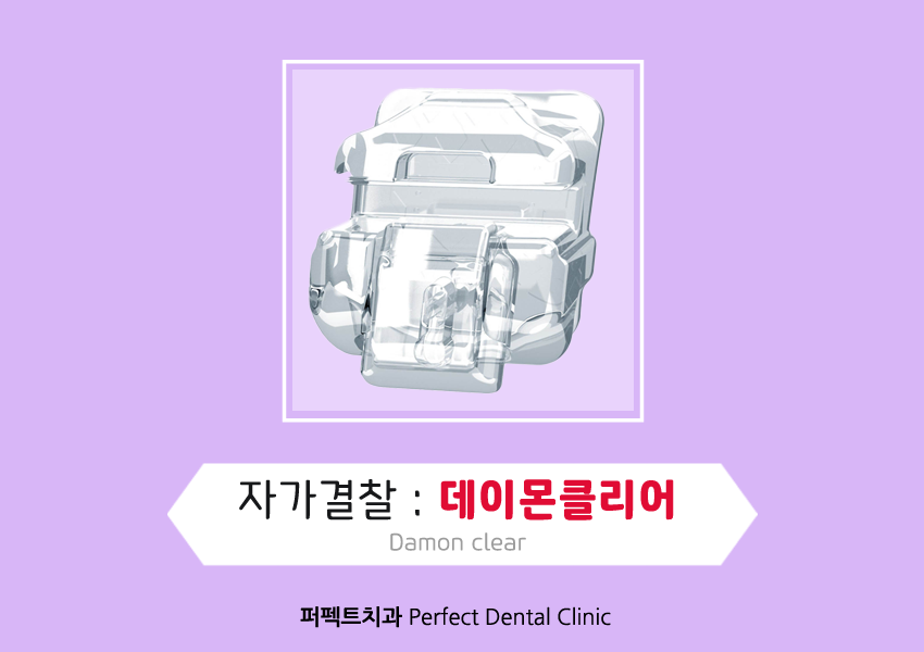 부정교합 치아교정은~? 관련 이미지 5