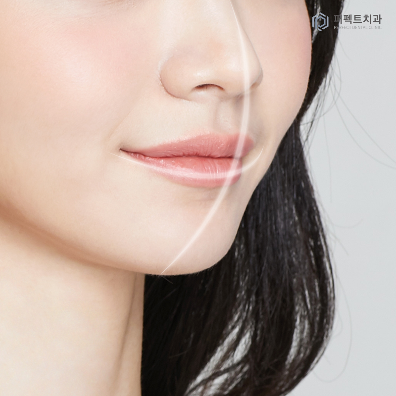 치아교정 중 코성형 해도 될까요? 관련 이미지 3