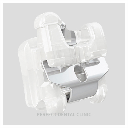 자가결찰 클리피씨전체교정 비용은 어떻게? 관련 이미지 1