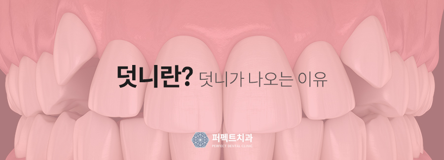 덧니교정,발치 꼭 해야되나요? 관련 이미지 2