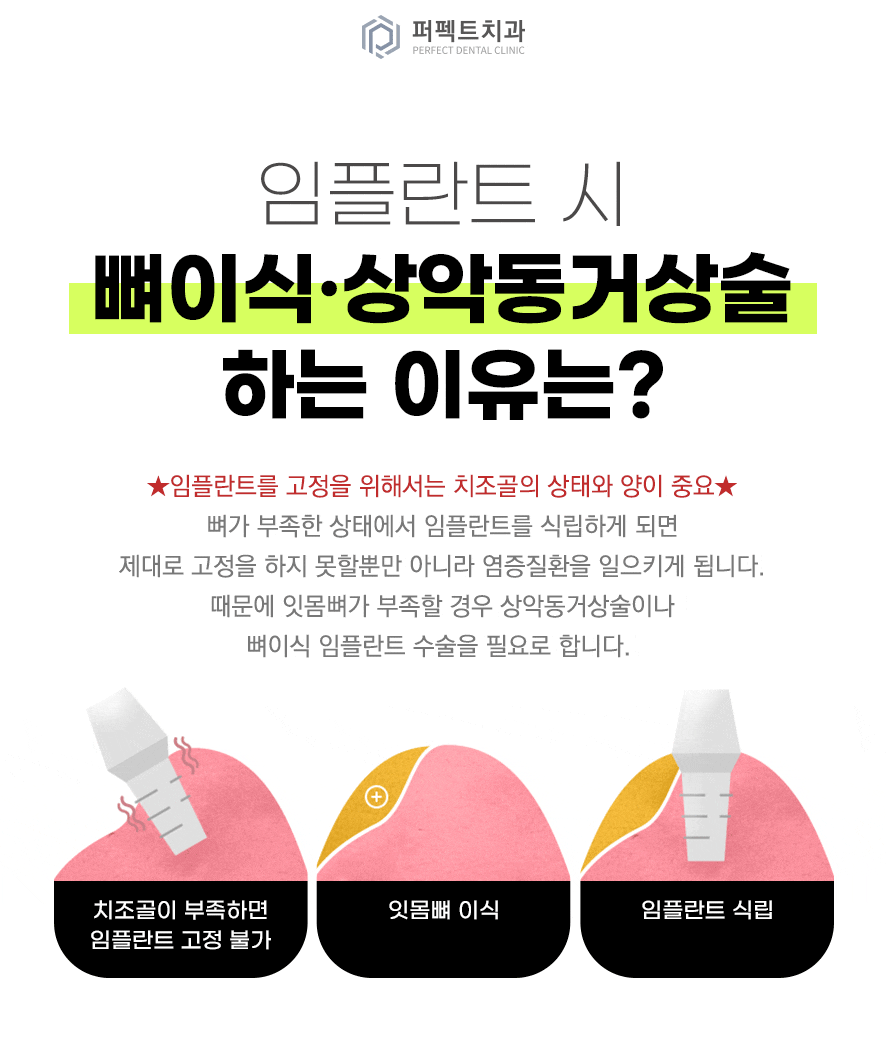 컴퓨터 분석을 통한 임플란트 관련 이미지 9