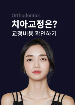 치아교정기간 단축방법 꿀★팁 관련 이미지 3