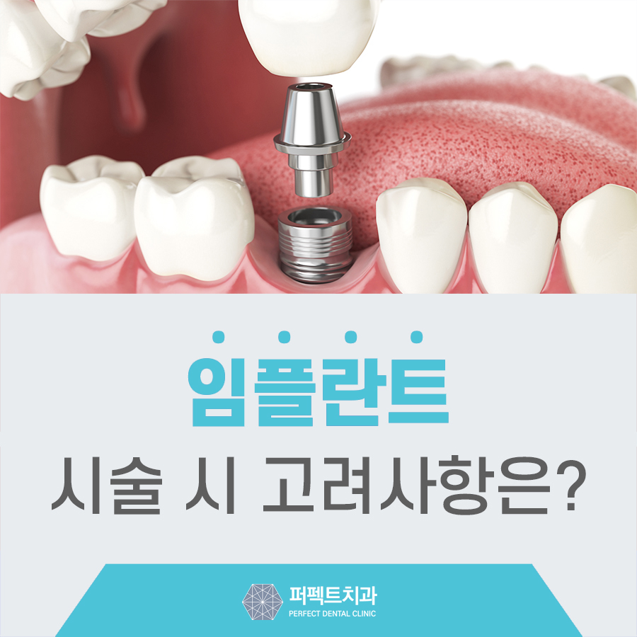 임플란트 전 고려해야 할 사항은? 관련 이미지 1