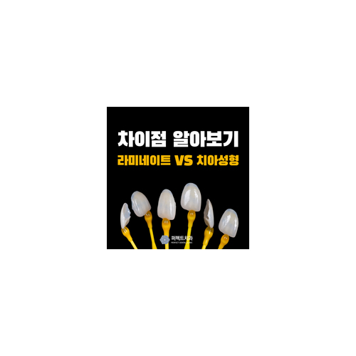 라미네이트와 치아성형 큰 차이점 관련 이미지 6