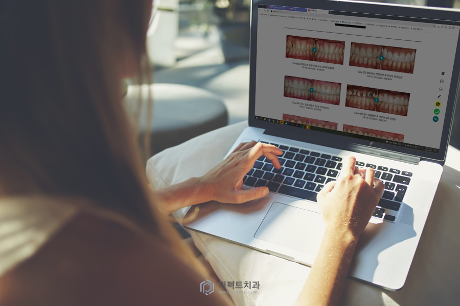 라미네이트 시 치과 선택의 기준은? 관련 이미지 3