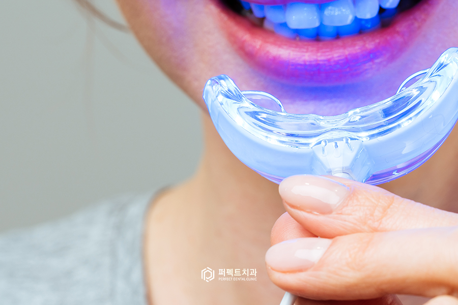 치아미백｜통증, 주기, 주의사항 관련 이미지 2