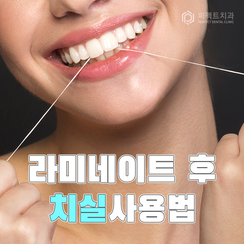 라미네이트 후 치실 사용방법은? 관련 이미지 1