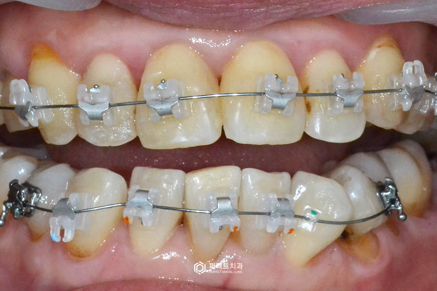 라미네이트를 하면 안되는 경우도 있다? 관련 이미지 5