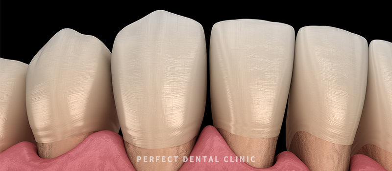 잇몸염증 증상과 좋은 음식 관련 이미지 2
