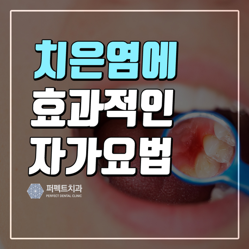 치은염 효과적인 자가요법! 관련 이미지 1