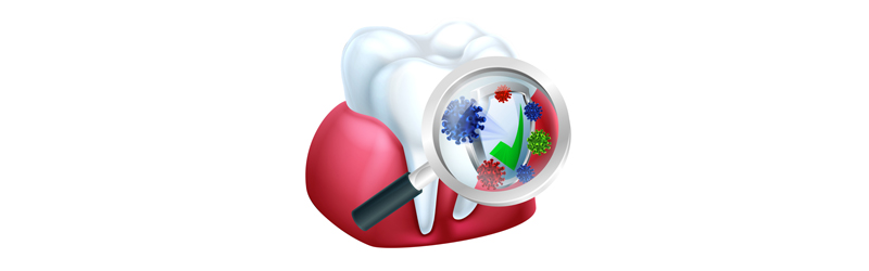 구강 박테리아, 들어봤어? 관련 이미지 3