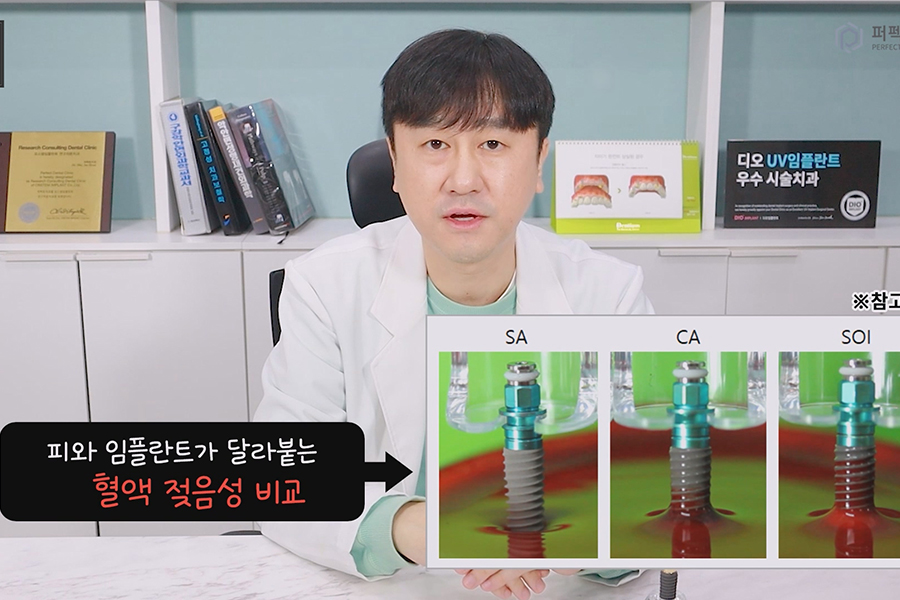 치료 기간을 단축 시킬 수 있는 임플란트의 종류는? 관련 이미지 3