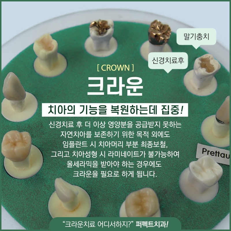 지르코니아크라운 저렴하게 할 수 있어! 관련 이미지 2