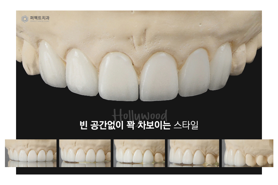 라미네이트를 해야한다면? 색상, 모양을 결정하는 tip! 관련 이미지 2